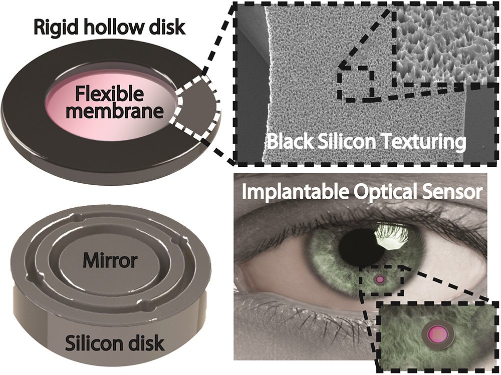 Implant