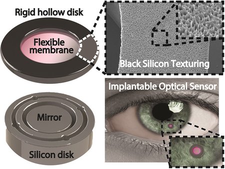 Implant