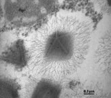 A black and white transmission electron microscopy image of a mimivirus exhibiting the distinctive stargate structure